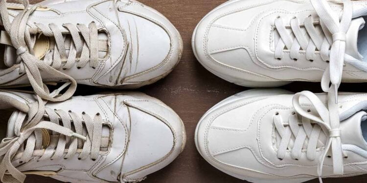 Tire AGORA mesmo o amarelo e o CHULÉ do seu tênis branco com esses 2 ingredientes