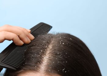 receitas caseiras para caspa