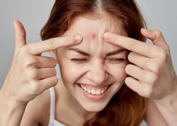 receitas caseiras para espinhas