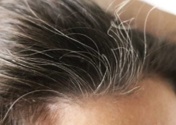 3 ingredientes que ajudam a escurecer os cabelos brancos