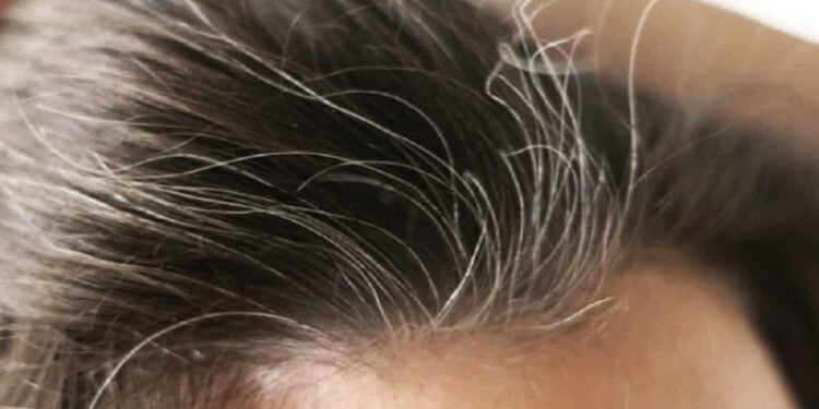 3 ingredientes que ajudam a escurecer os cabelos brancos