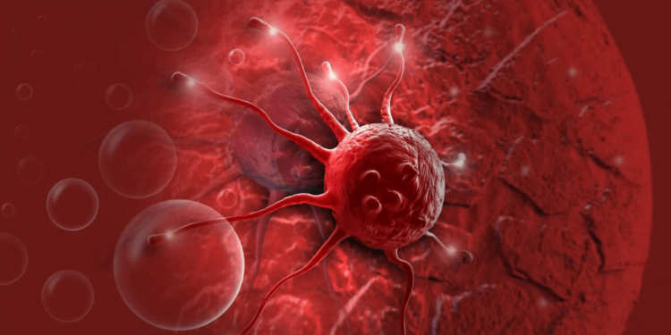 Alerta! Esses são os tipos de CÂNCER mais silenciosos