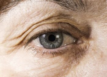 ELIMINE as rugas dos olhos e REJUVENESÇA com este PODEROSO creme regenerador caseiro