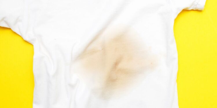 Como tirar mancha de gordura das roupas?