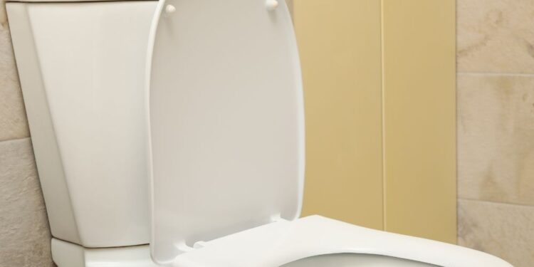 Aprenda a branquear o assento do vaso sanitário com este truque