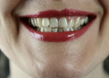 o que significa sonhar com dente